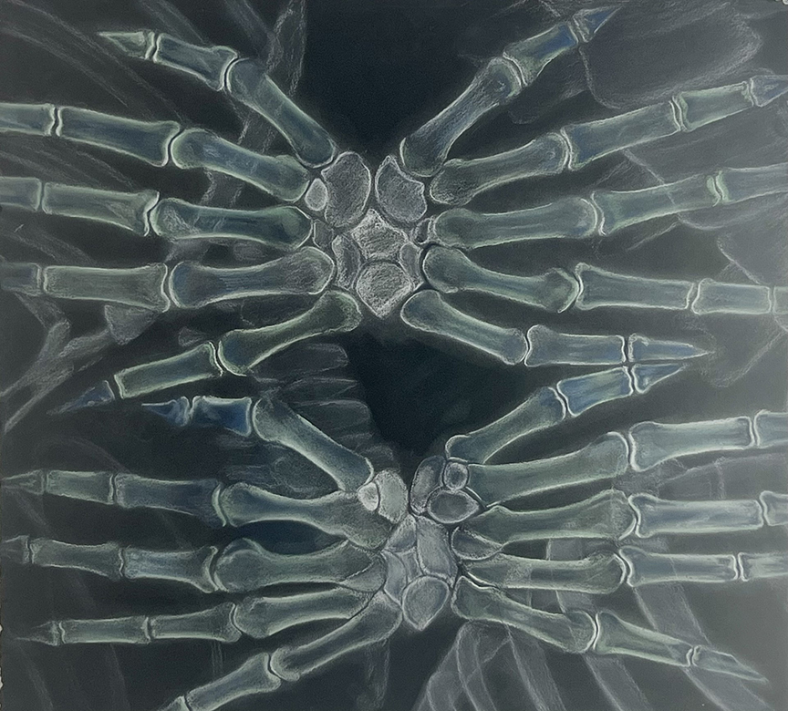 Drawing of x-ray of hands.