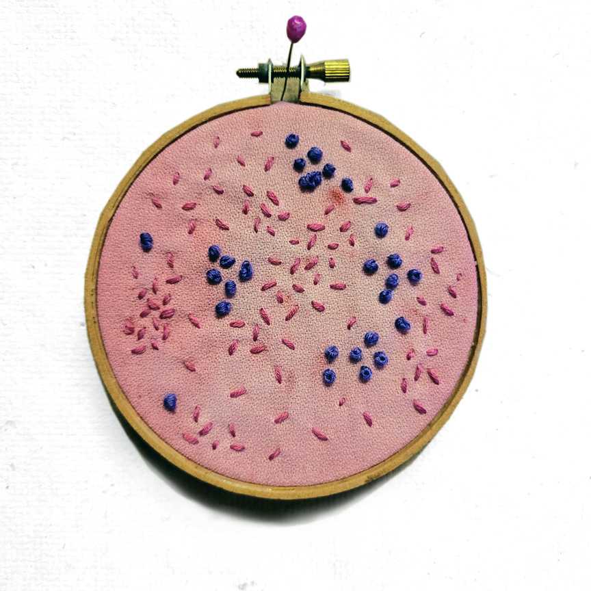 Embroidery features a Gram stain with both positive and negative bacteria.
