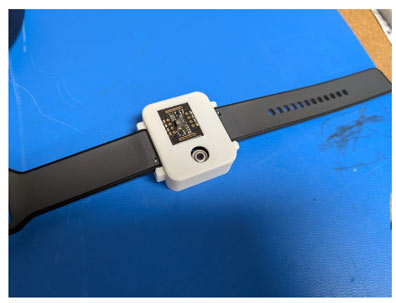 Custom Wearable Prototype with 3D-Printed Enclosure