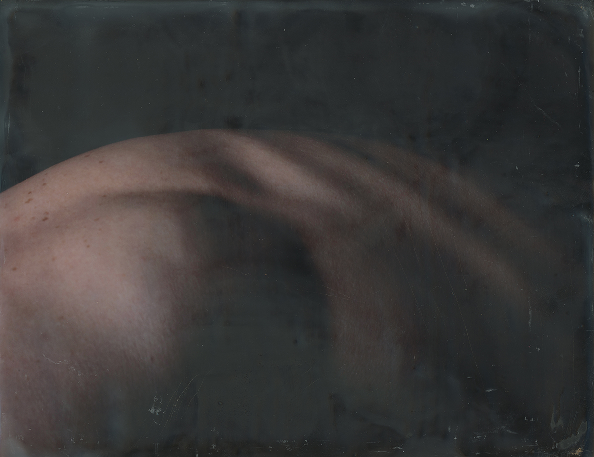 Photograph of someone's back.