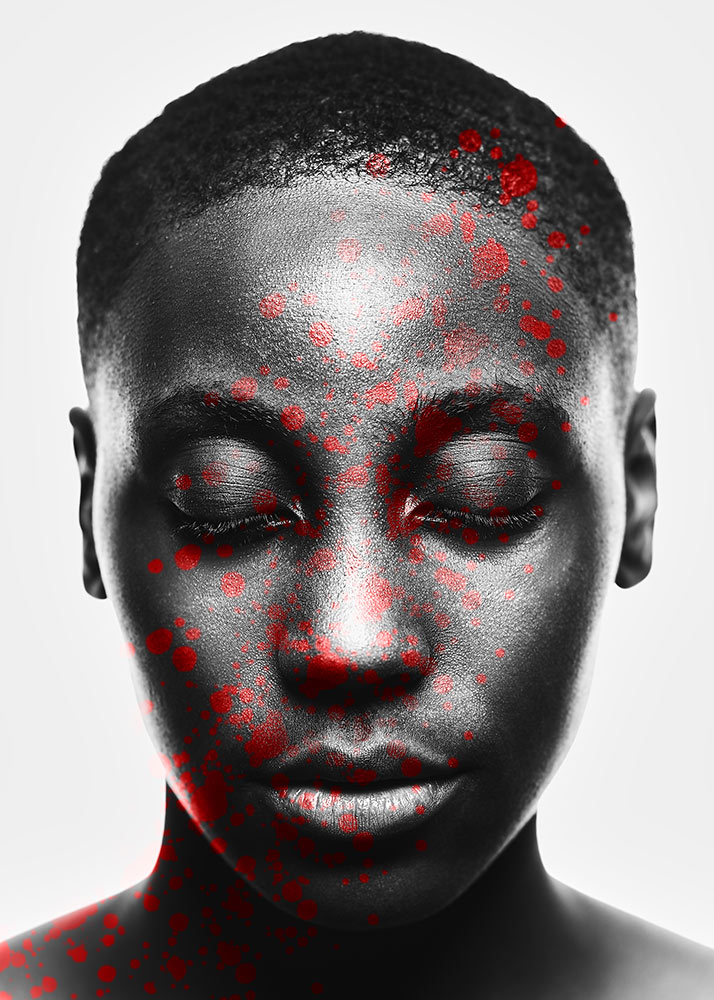 Photo by Kamau Bostic shows woman's face with eyes closed looking down and red spots on image